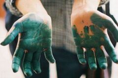Чем отмыть зеленку с кожи рук