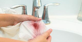 Чем отстирать пятно от свеклы